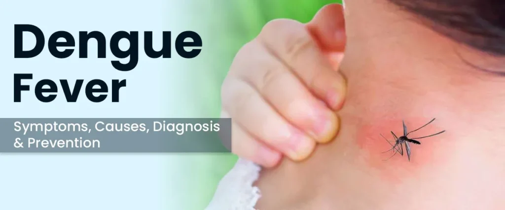The Signs and Remedy of Dengue Fever