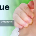 The Signs and Remedy of Dengue Fever