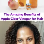 Apple Cider Vinegar: The Undercover Element for Sparkling Pores and skin and Hair