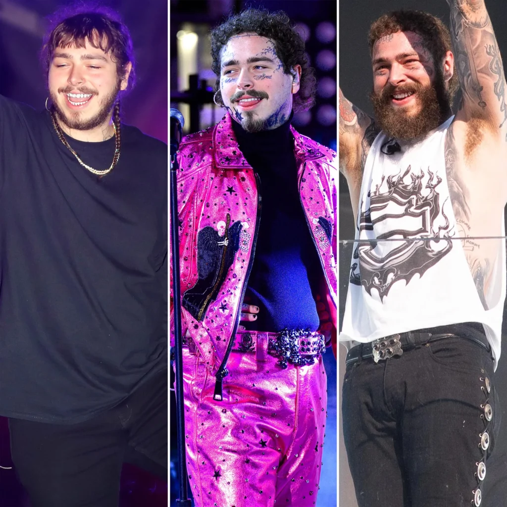 Publish Malone’s Weight Loss Proceed: Inside of His Transformation | , malone’s