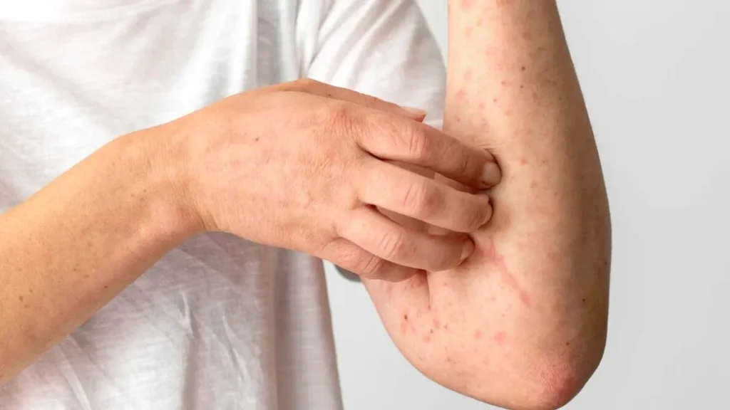 Understanding Where You Typically Itch with Liver Problems – Itching | , understanding