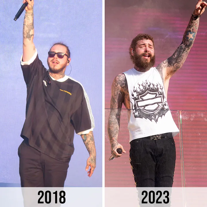 Post Malone Sheds Pounds: Inside His Incredible Weight Loss Journey