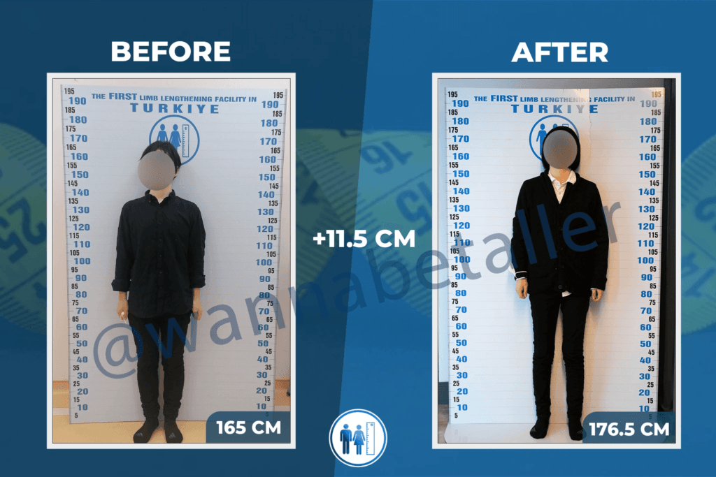 Understanding Height Preferences: What Is Considered Tall In Japanese Culture?