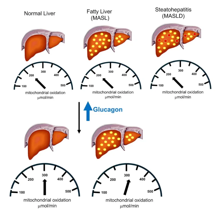 Boosting Fat Oxidation for Better Liver Function: A Closer Look