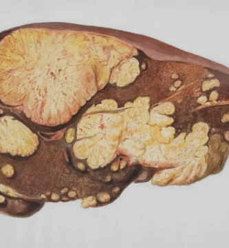 Maximizing Weight Loss Results with Liver Support Supplements