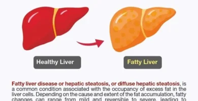 Understanding the Connection Between Belly Fat and Liver Disease